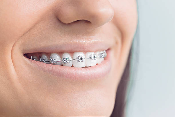 Best Dental Inlays and Onlays  in Citrus City, TX